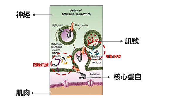 微整形,玻尿酸拉提,輪廓,微整,肉毒,肉毒咀嚼肌,醫美療程,保養,韓國醫美,淡化細紋,肉毒桿菌,瘦臉針,肉毒瘦小臉,效果,咀嚼肌肉毒,抬頭紋,眼下細紋,動態眼下細紋,魚尾紋,肉毒 副作用,肉毒小臉,肉毒 平躺,肉毒價格,肉毒效果,肉毒除皺,酒糟肉毒,瘦腿針,肉毒桿菌素,肉毒桿菌素 副作用,肉毒瘦小臉 後遺症,魚尾紋 肉毒,眼下細紋 醫美,抬頭紋 肉毒,皮膚鬆垂,皮膚鬆垂 肉毒,肉毒 瘦小臉,肉毒桿菌 抬頭紋,肉毒桿菌素,膚質,肉毒桿菌 皺眉紋,皺眉紋 消除,皺眉紋 肉毒,魚尾紋,抬頭紋深,肉毒素注射,botox,dysport