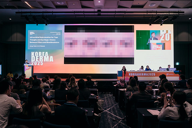 koreaderma, tear trough, 淚溝, 微整形, 玻尿酸, 膠原蛋白增生劑, sculptra, hyaluronic acid