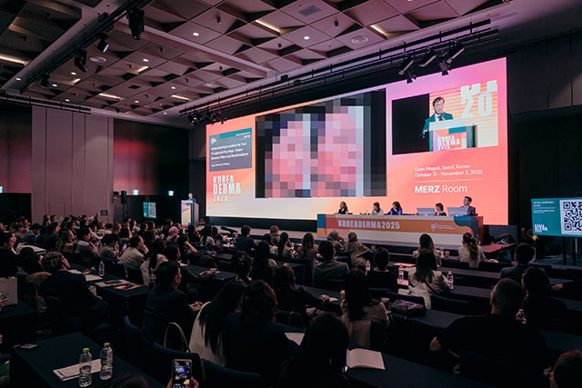 koreaderma, tear trough, 淚溝, 微整形, 玻尿酸, 膠原蛋白增生劑, sculptra, hyaluronic acid